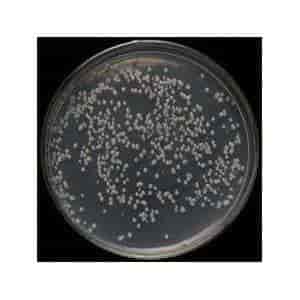 BL21 Gold PlysS (DE3) chemically E.coli Express Competent Cells